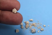 Infusiones para prevenir cálculos renales: qué se sabe y qué no. Imagen destacada sobre infusiones para prevenir cálculos renales. publicada en Novedades Web